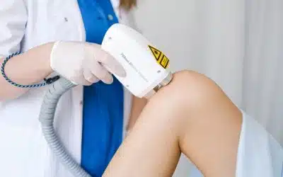 2 grandes raisons de choisir l’épilation au laser