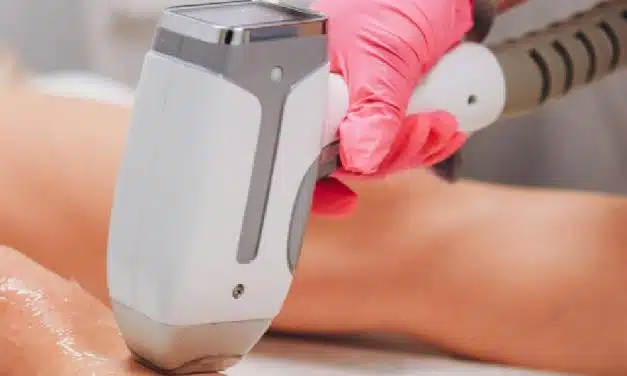 Épilation laser : déroulement et avantages de cet intervention