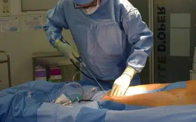 Liposuccion : comment éliminer les graisses tenaces et sculpter sa silhouette efficacement