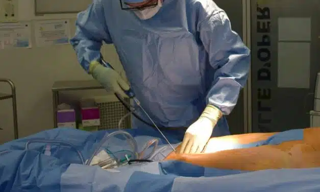 Liposuccion : comment éliminer les graisses tenaces et sculpter sa silhouette efficacement